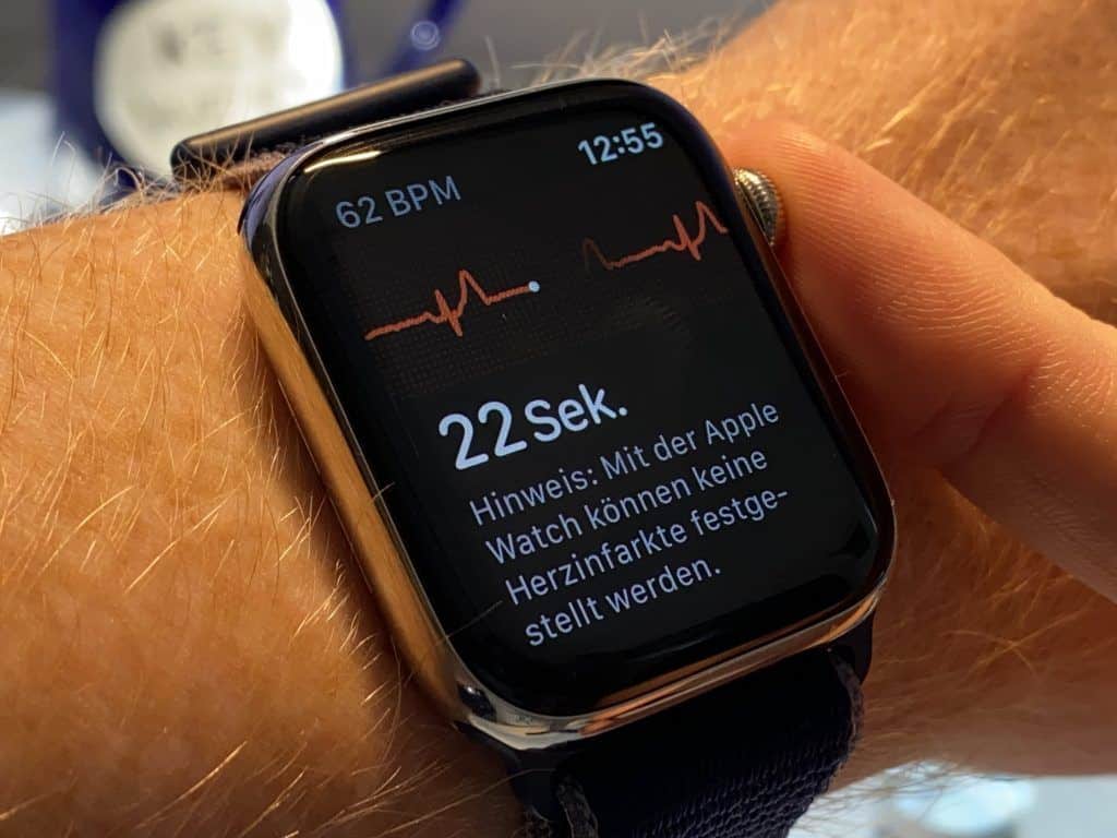 Wie sinnvoll ist die Apple Watch? Apple Watch sinnvoll Smartwatch mit EKG (Elektrokardiogramm): Wie zuverlässig ist die Aufzeichnung des 1-Kanal-EKGs? Foto: Sascha Tegtmeyer
